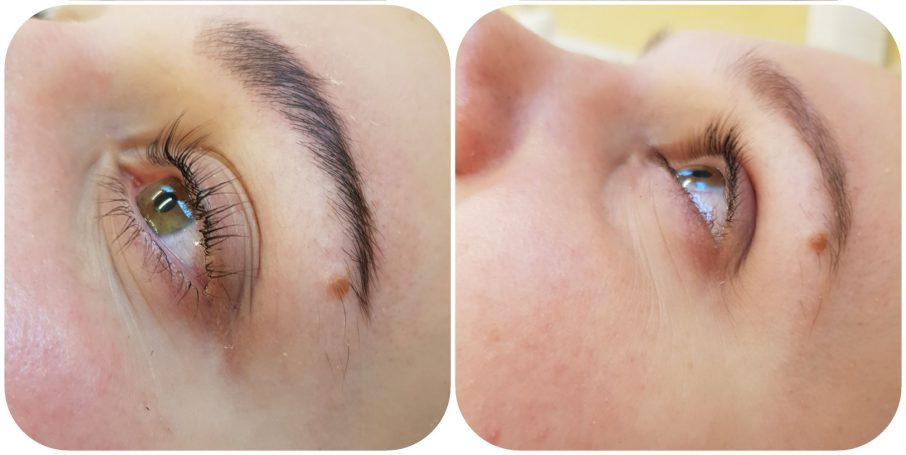 Wimpern-Augenbrauenlifting